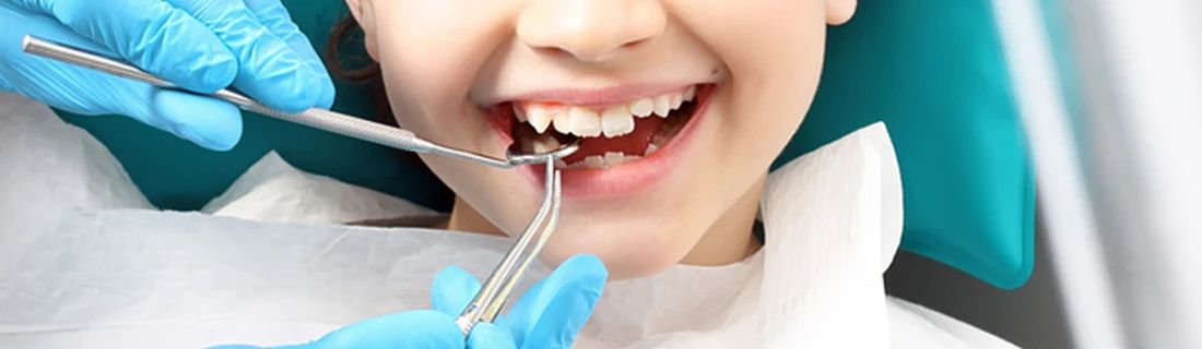 Tooth Extractions in Phoenix AZ Tooth Extractions in Phoenix AZ