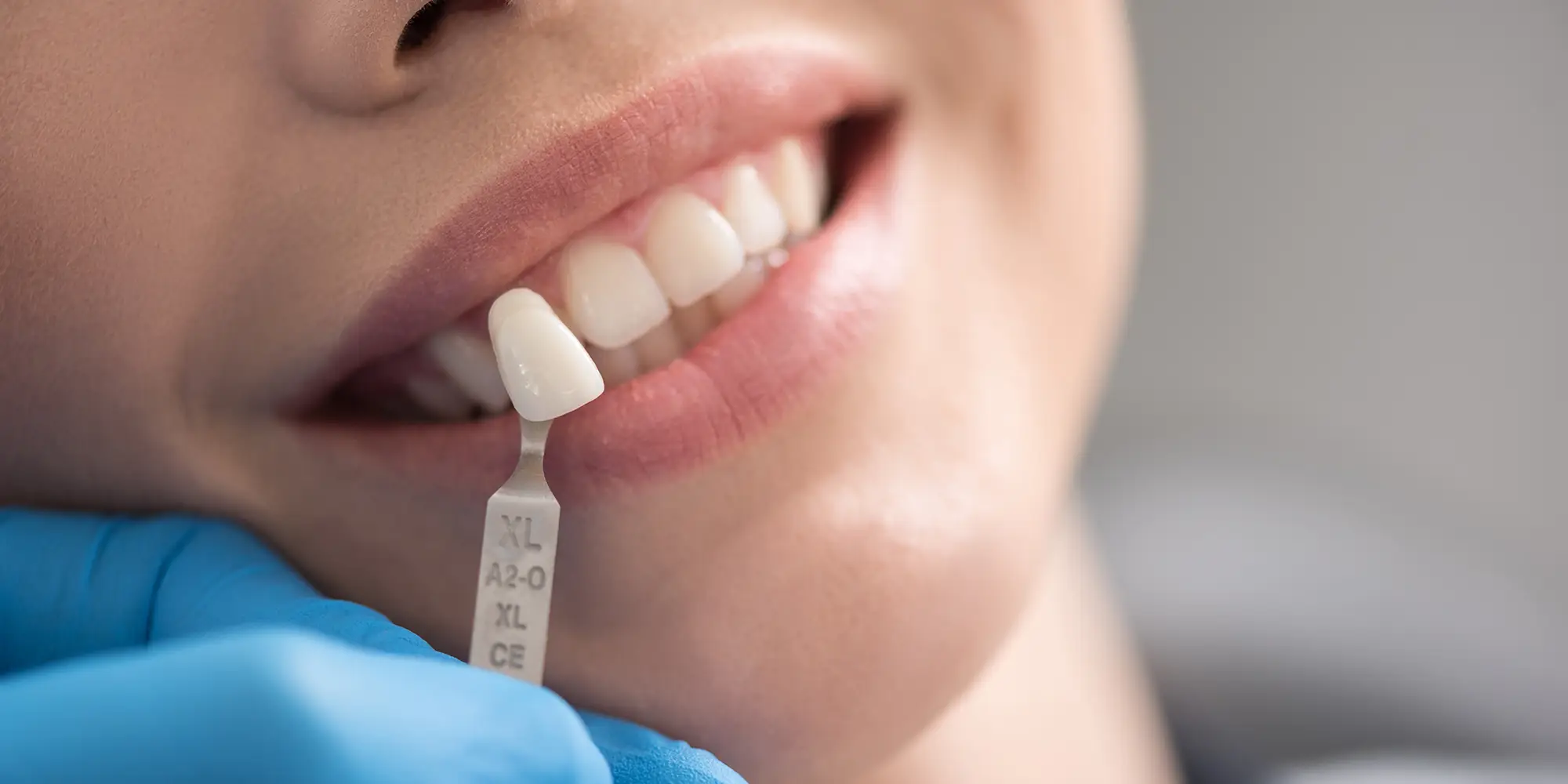 Dental Phoenix AZ Implants Dental Phoenix AZ Implants